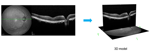 猴眼的光学断层相干扫描（OCT）.jpg