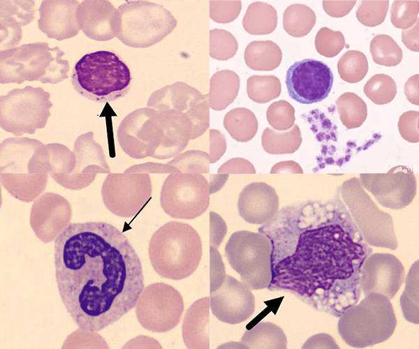 形态学检测-外周血涂片细胞形态分类.jpg