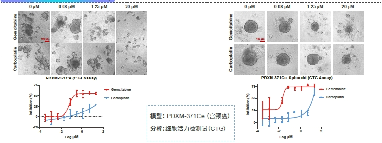 PDXO - 药物筛选.webp