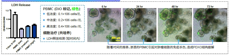 PBMC PDXO共培养 - 免疫细胞毒性研究.webp