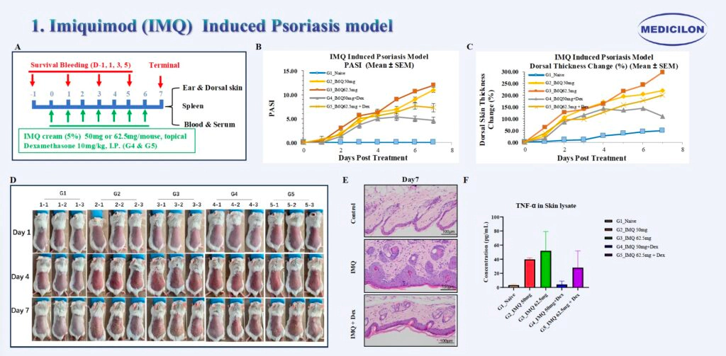 1 咪喹莫特 (IMQ) 诱导的银屑病模型.webp