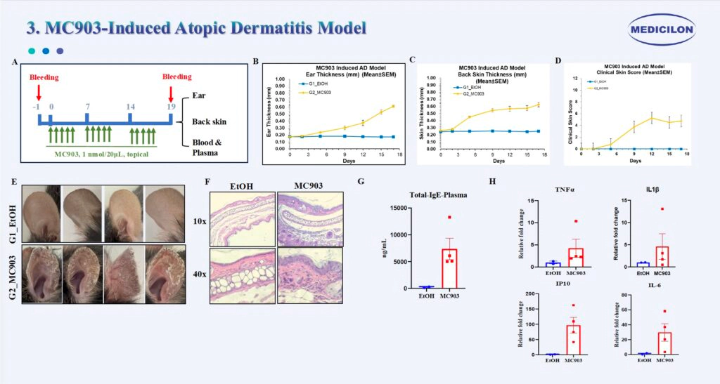 3 MC903诱导的特应性皮炎模型.webp