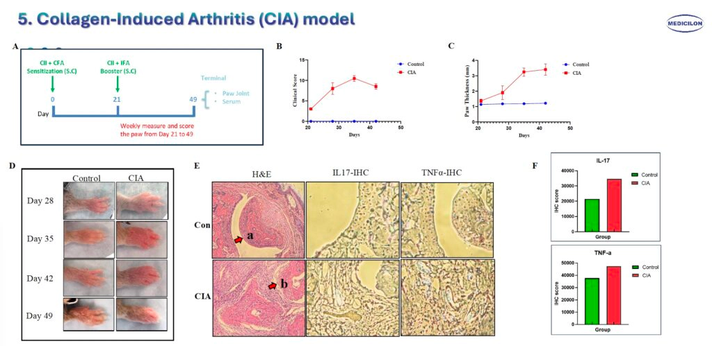 5 胶原蛋白诱导关节炎（CIA）模型.webp